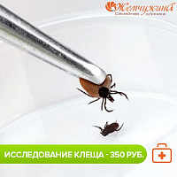 Стоимость исследование клеща на наличие вируса энцефалита - 350 рублей
